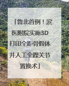 鲁北首例！滨医附院实施3D打印全距骨假体并人工全踝关节置换术